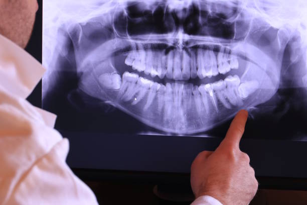 Best Emergency Treatment for Oral Infections in Point Pleasant Beach, NJ